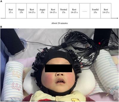 The Neural Processing of Vocal Emotion After Hearing Reconstruction in Prelingual Deaf Children: A Functional Near-Infrared Spectroscopy Brain Imaging Study
